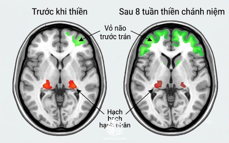 Biểu đồ quét não fMRI thay đổi chất xám sau khi thiền